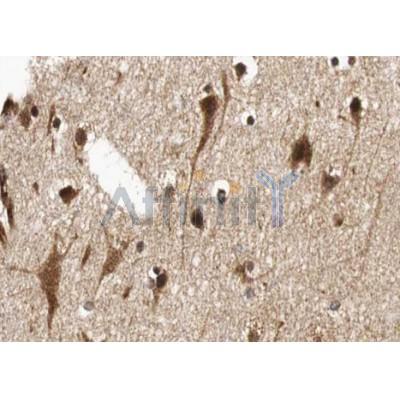 Валидация Affinity AF5204 - 2658