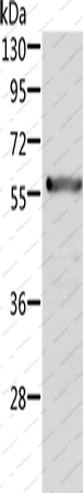 Вестерн-блоттинг, ALDH6A1, ткань почки крысы