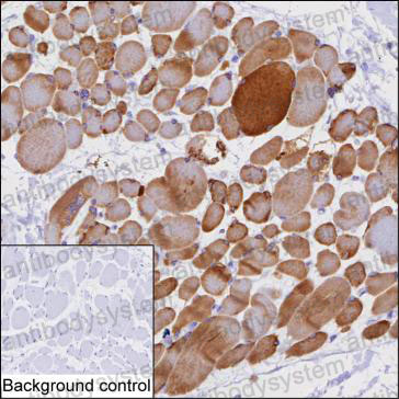 Валидация AntibodySystem RHC31703