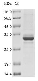 SDS-PAGE