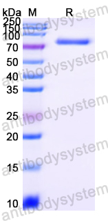 YXX21101, SDS-PAGE