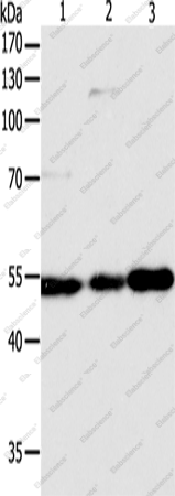Вестерн-блоттинг, GSR, клетки Jurkat, HeLa и A549