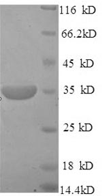 SDS-PAGE