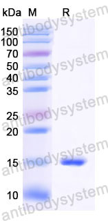 Валидация SDS-PAGE - AntibodySystem RHJ61601