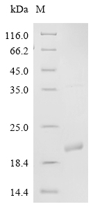 SDS-PAGE