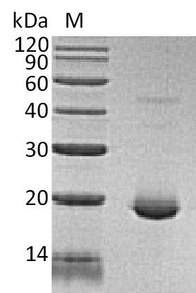 SDS-PAGE