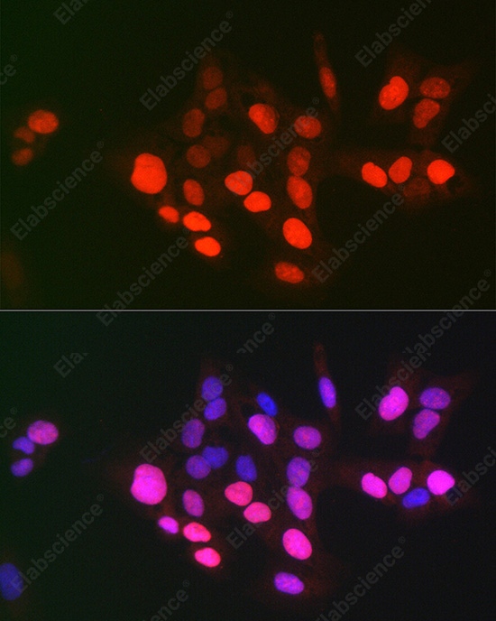 Иммунофлуоресценция, DNA topoisomerase II alpha, клетки U-2 OS