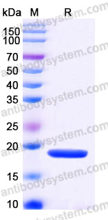 AHD29701, SDS-PAGE