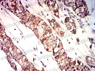 Валидация AntibodySystem RHD01401 (1272)