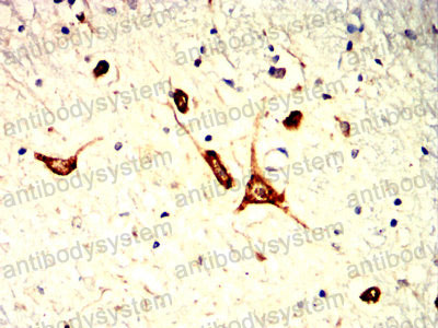 Валидация AntibodySystem RHB98006 (518)