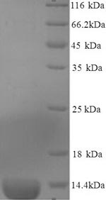 SDS-PAGE