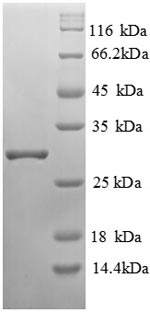 SDS-PAGE