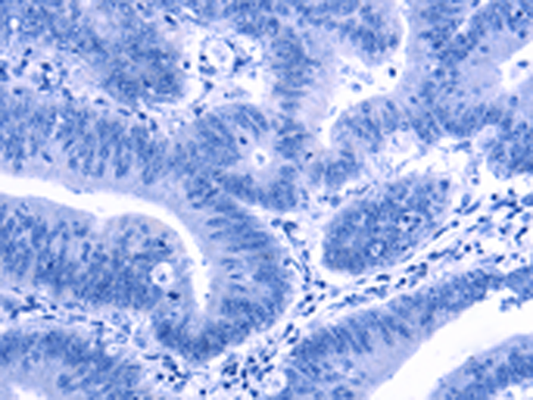 Валидация AssayVector ARM2302(3966)