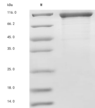SDS-PAGE