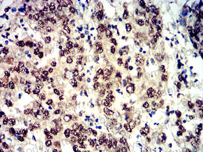 Валидация AntibodySystem RHG57907 (3002)