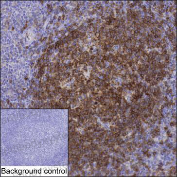 Валидация AntibodySystem RHJ53701