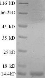 SDS-PAGE