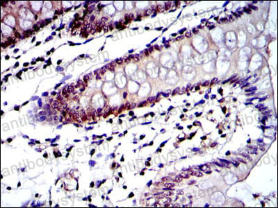 Валидация AntibodySystem RHD76102