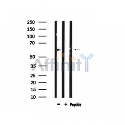 Валидация Affinity DF3798 - 14912