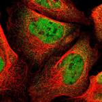 Валидация AssayVector ARM2133(3435)