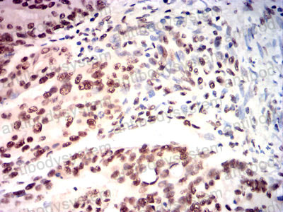 Валидация AntibodySystem RHJ35603