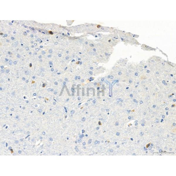 Валидация Affinity DF6392 - 17755