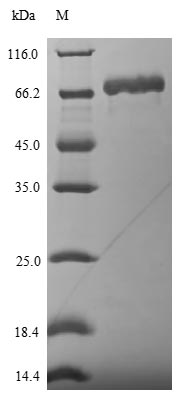 SDS-PAGE