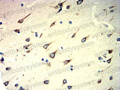 Валидация AntibodySystem RHD40503