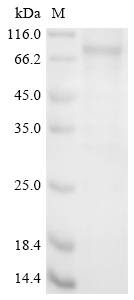 SDS-PAGE