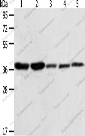 Вестерн-блоттинг, ANXA1, клеточные линии A431, NIH/3T3, HeLa, Jurkat и PC3