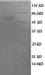 SDS-PAGE