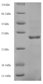 SDS-PAGE