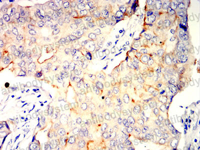 Валидация AntibodySystem RHN98902 (4038)