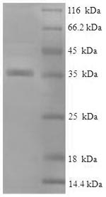 SDS-PAGE