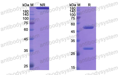 Валидация SDS-PAGE - AntibodySystem DHJ72802