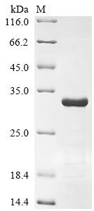 SDS-PAGE