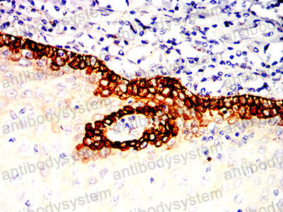 Валидация AntibodySystem RHB98004