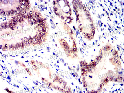 Валидация AntibodySystem RHE73903 (2301)