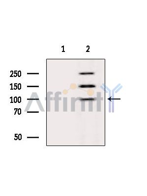 Валидация Affinity DF6318 - 17644