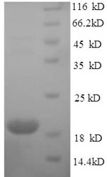 SDS-PAGE