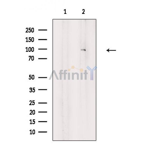 Валидация Affinity AF6863 - 4081