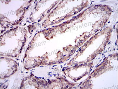 Валидация AntibodySystem RHF60802 (2589)
