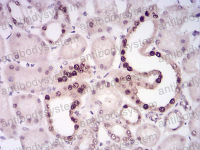 Валидация AntibodySystem RHG14204 (2870)