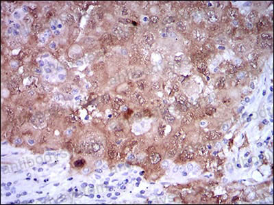 Валидация AntibodySystem RHE37707 (2134)