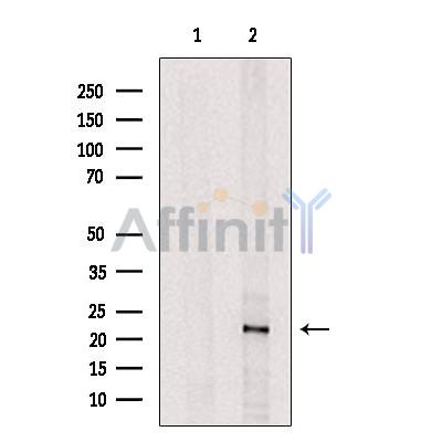Валидация Affinity DF12493 - 7067