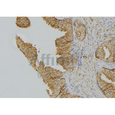 Валидация Affinity AF5353 - 2956