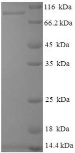 SDS-PAGE