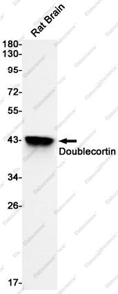Вестерн-блоттинг, Doublecortin, клетки мозга крысы