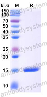 Валидация SDS-PAGE - AntibodySystem RHD12603
