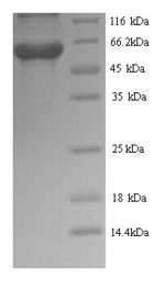SDS-PAGE